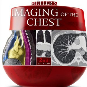 Elsevier Expert Radiology Kindle Edition-0