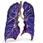 Pulmonary Medicine Elsevier Kindle Textbook-0